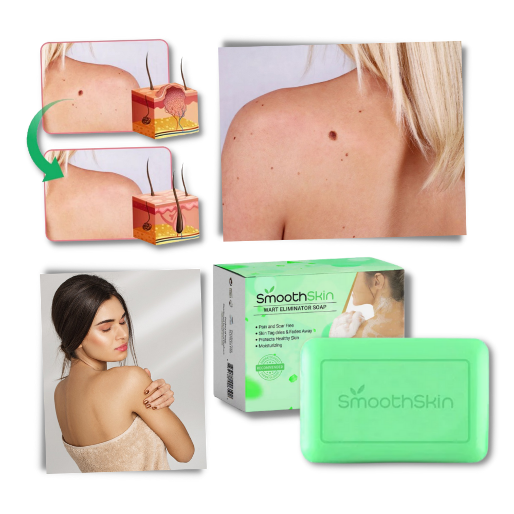 Savon exfoliant hydratant contre les verrues
- Ozerty