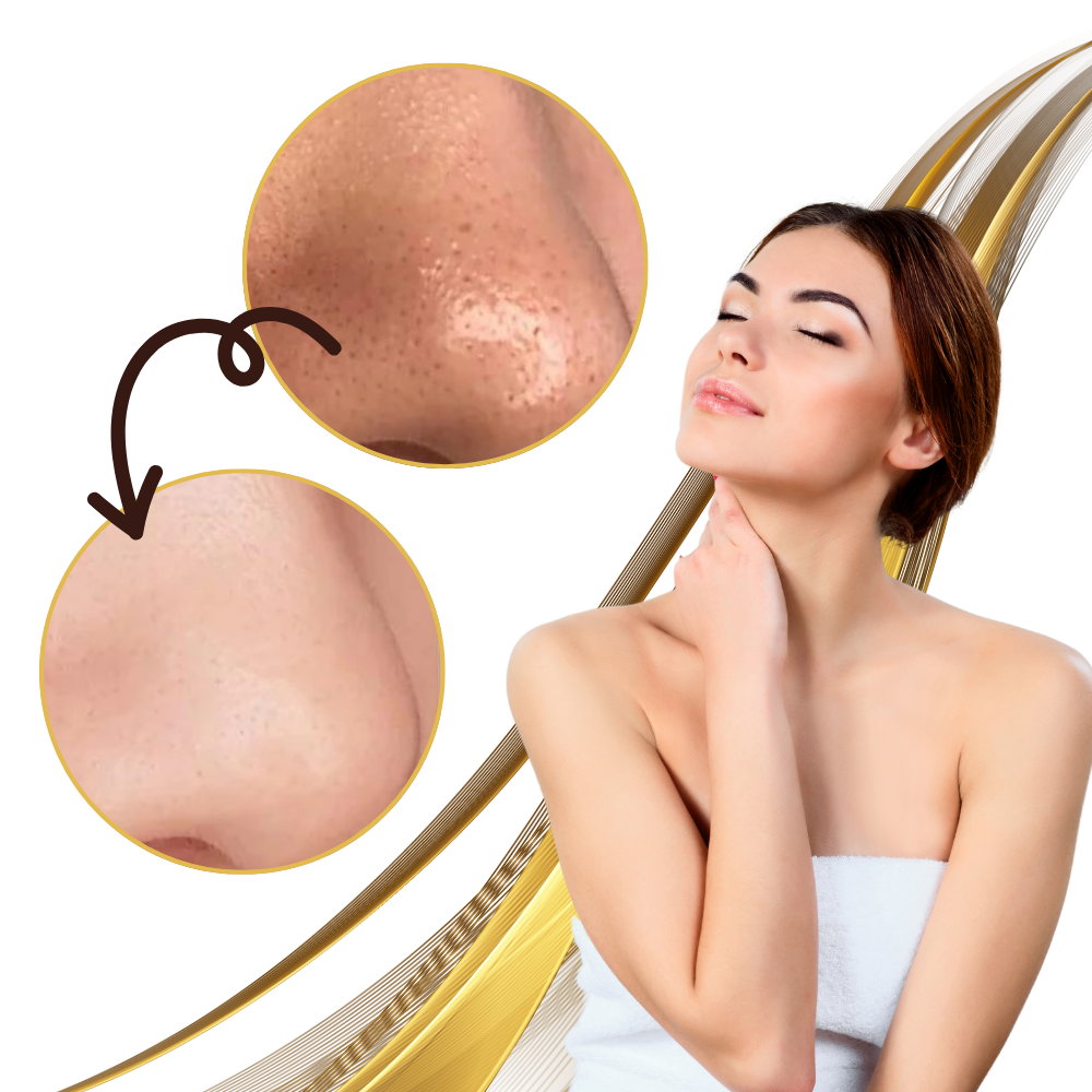 Masque doré peel-off pour le nettoyage des pores
- Ozerty