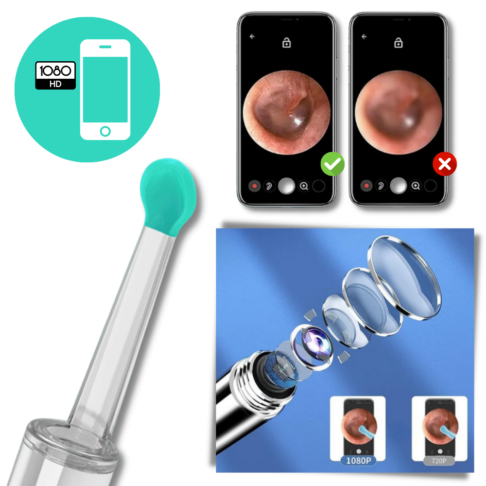 Caméra de nettoyage d'oreille pour retirer le cérumen
- Ozerty