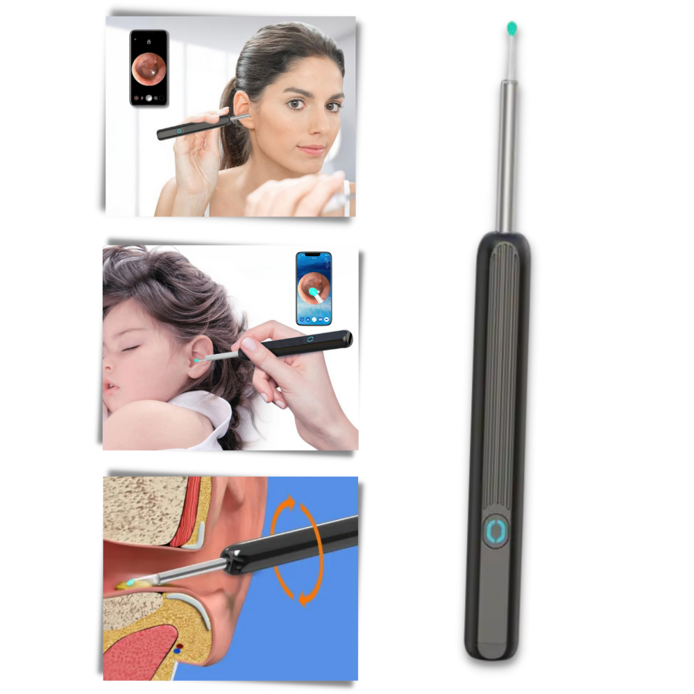 Caméra de nettoyage d'oreille pour retirer le cérumen
- Ozerty