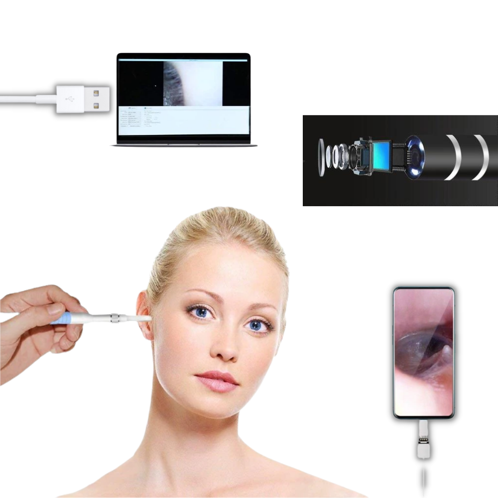 Caméra auriculaire 3 en 1 - Ozerty