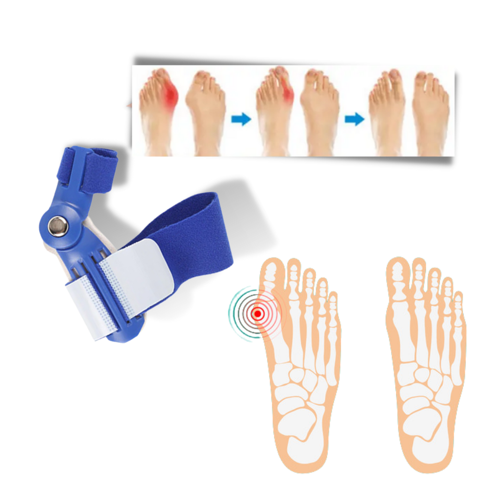Correcteur d'oignon au pied orthopédique - Ozerty