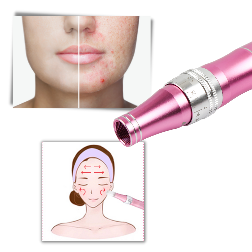 Stylo Dermique de Micro-aiguilletage - Ozerty