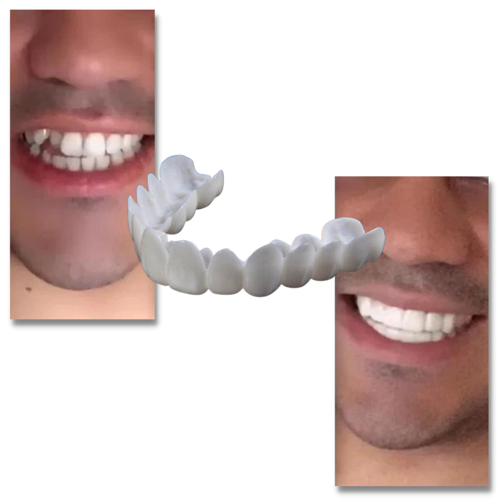 Couverture dentaire sourire parfait - gouttière confortable - Ozerty