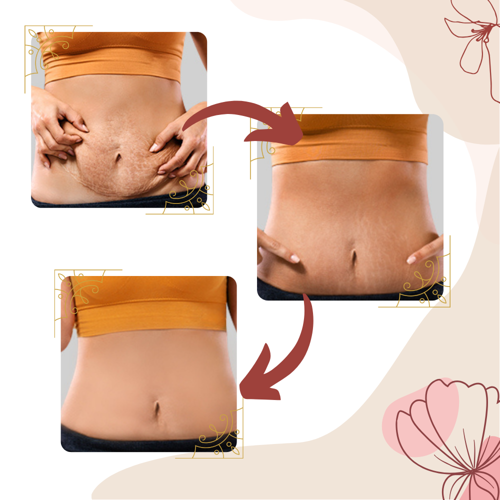 Masseur anti-cellulite par vibrations à haute fréquence

 - Ozerty