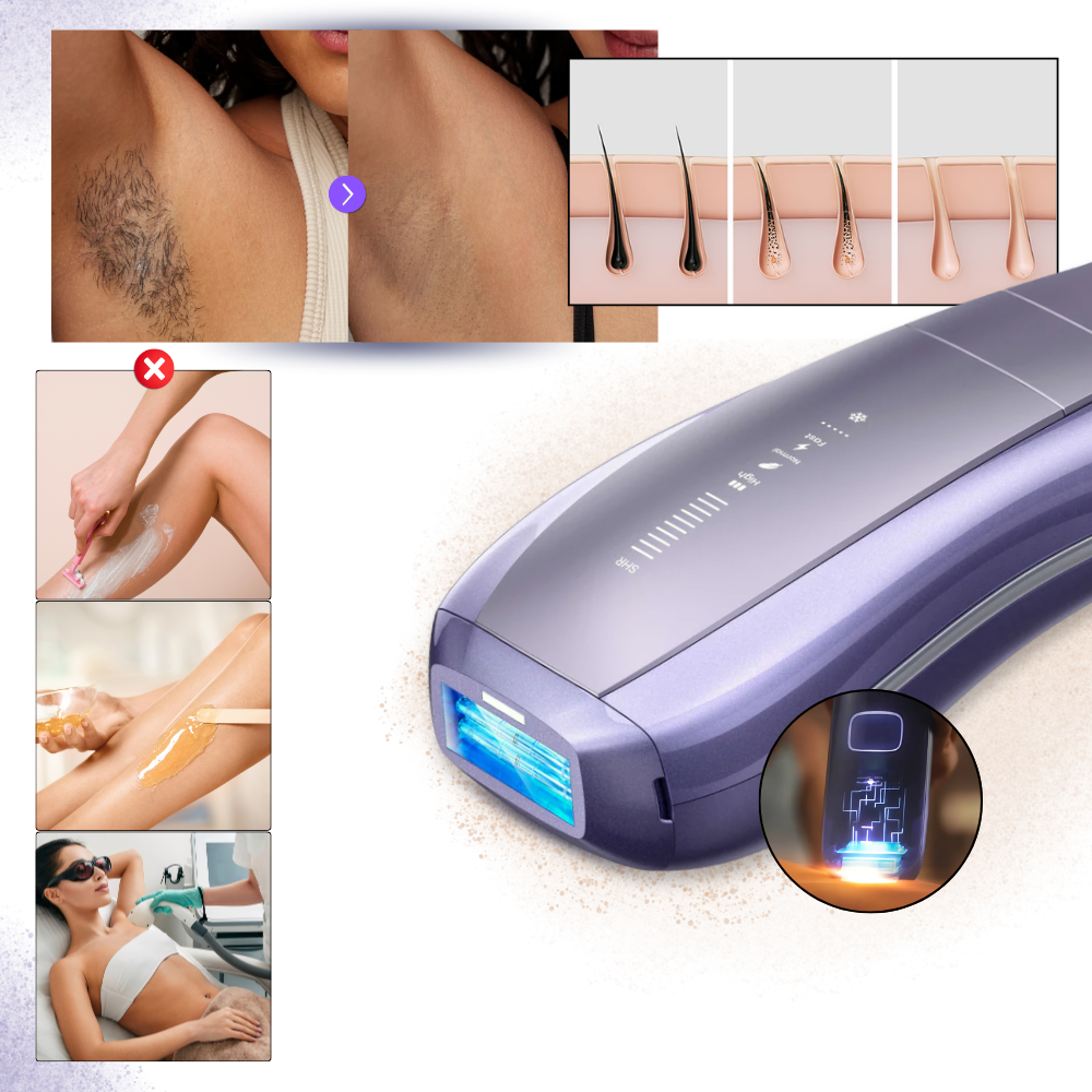 Appareil d'épilation laser - Ozerty