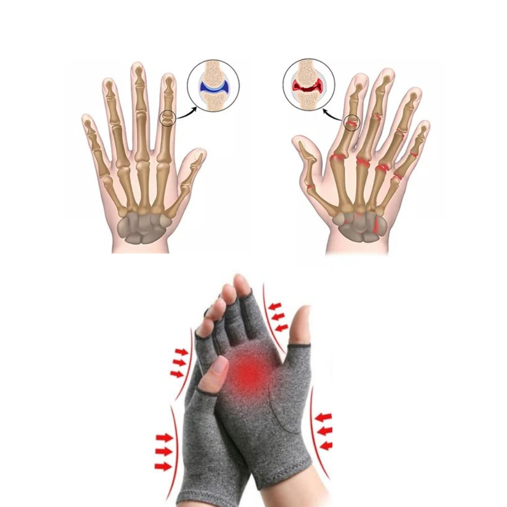 Gants de compression pour le soulagement des douleurs articulaires - Ozerty