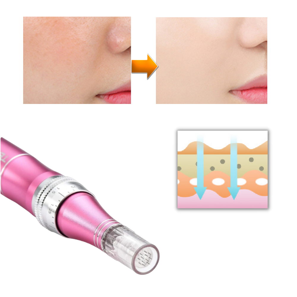 Stylo Dermique de Micro-aiguilletage - Ozerty