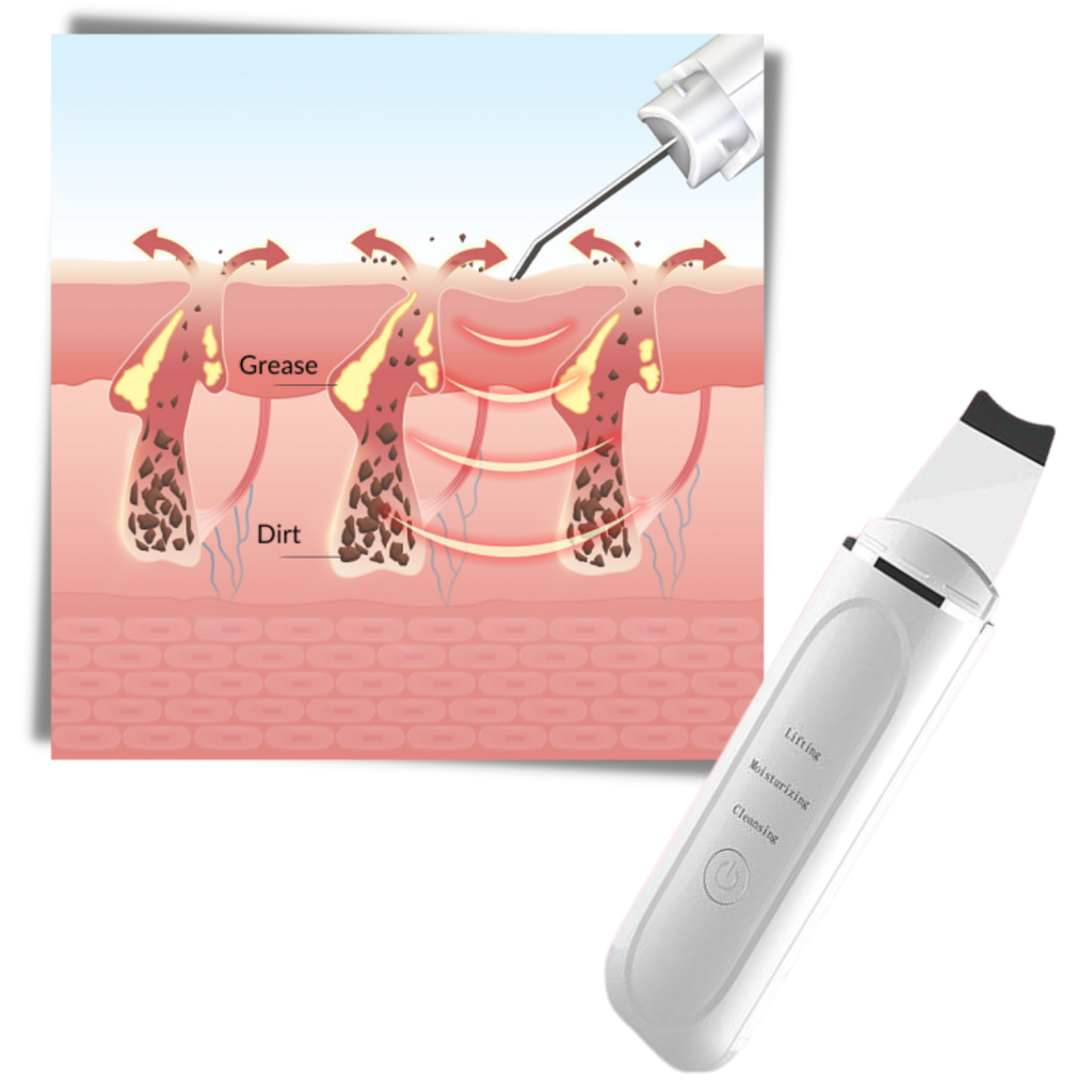 Spatule exfoliante ultrasonique pour le nettoyage en profondeur du visage - Ozerty